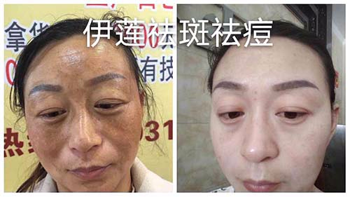 純中藥?kù)畎叽砑用苏猩? title=